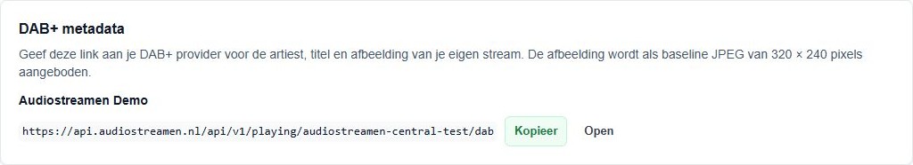 DAB+ metadata met uitleg over artiest, titel en de afbeelding van 320 bij 240 pixels